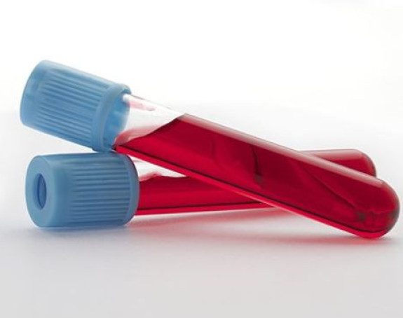 Непотребна употреба антибиотика биће елиминисана тестом крви?