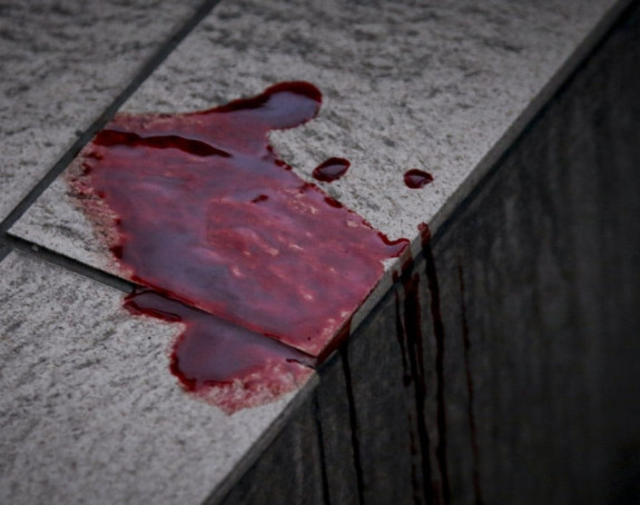 Video: Huligani Olija divljački tukli navijačicu PAO-a!