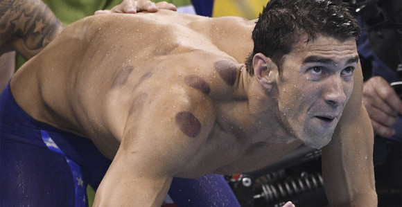 Evo zašto sportisti imaju crvene tačke