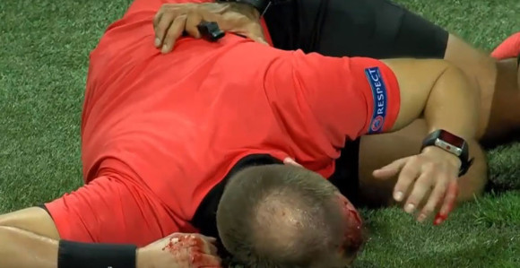Video: Horor u Gracu, sudiji flašom razbili glavu!