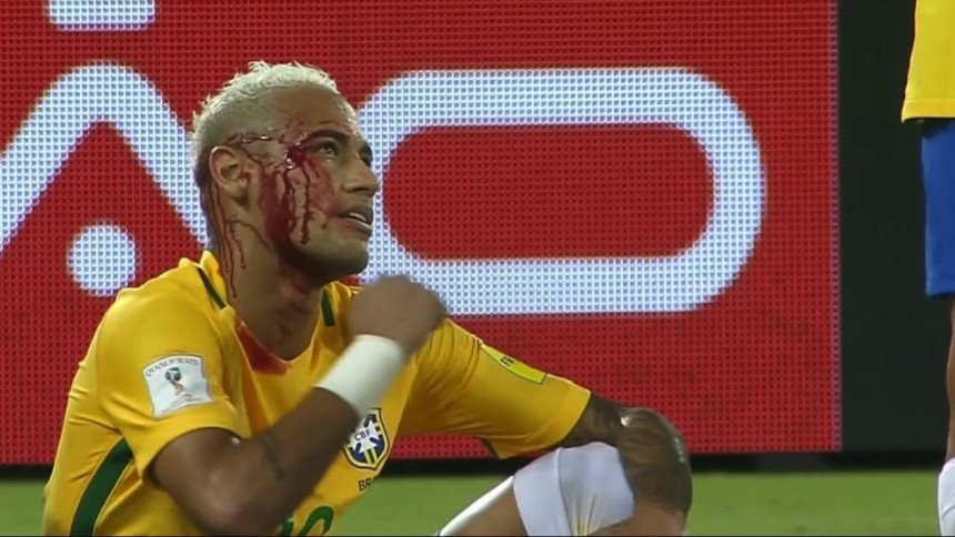 Video: "Nejmar se pravio važan i dobio...!"