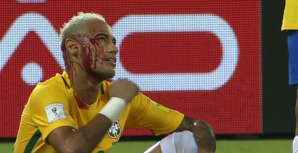 Video: "Nejmar se pravio važan i dobio...!"