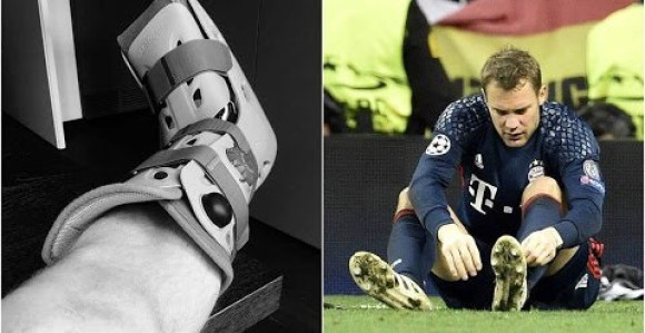 Nojer na štakama do kraja februara!