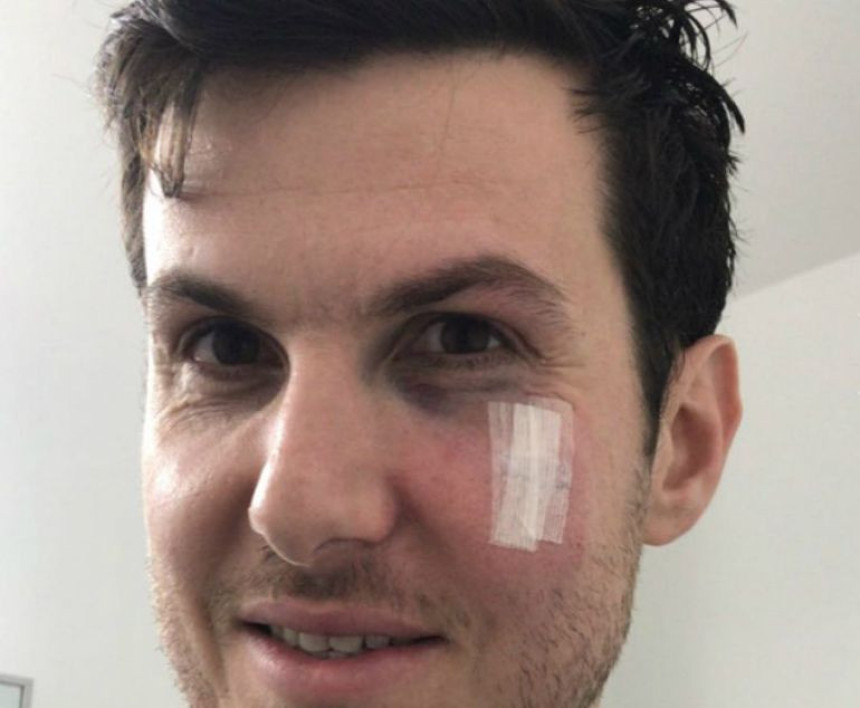 Sin Glena Rajsa prebio Gaja Pninija i dobio otkaz!