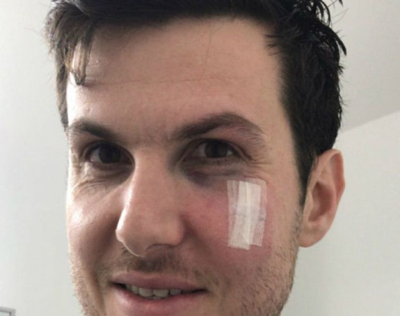 Sin Glena Rajsa prebio Gaja Pninija i dobio otkaz!