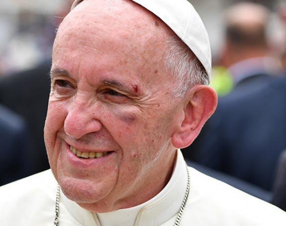 Папа повријеђен приликом посјете