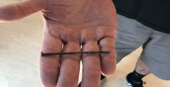 Ekserom sebe upucao u srce i preživeo!