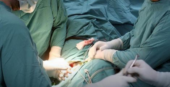 Samo srodničke transplantacije u RS