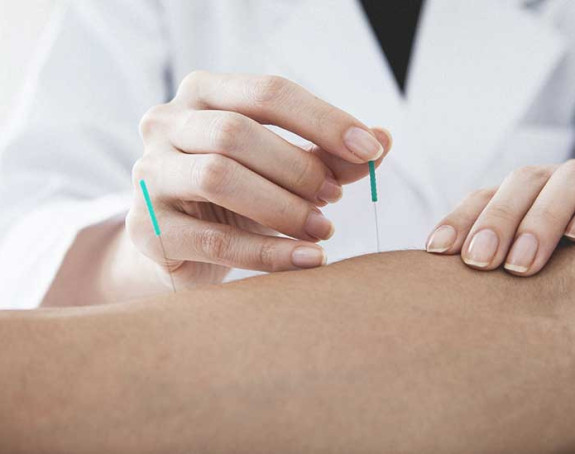 Akupunktura rješenje za menopauzu?