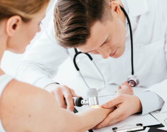 Sve više obolelih od melanoma