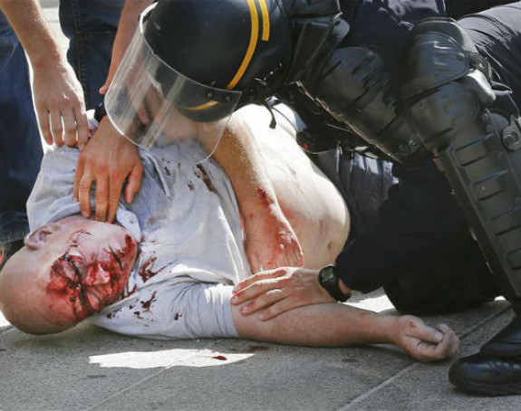 EURO - Marsej: 31 navijač u bolnici, dvojica kritično!