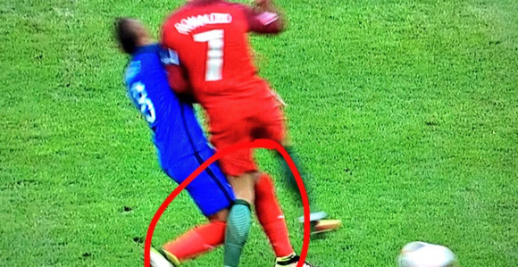 Ronaldo ven terena pet mjeseci?!