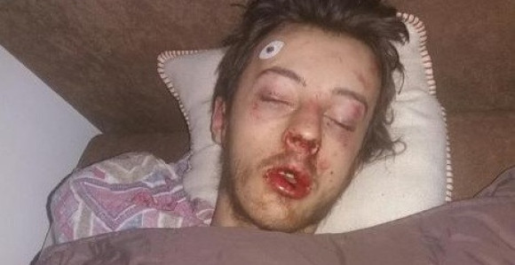 Pretukli ga, ošišali i vukli autom po asfaltu