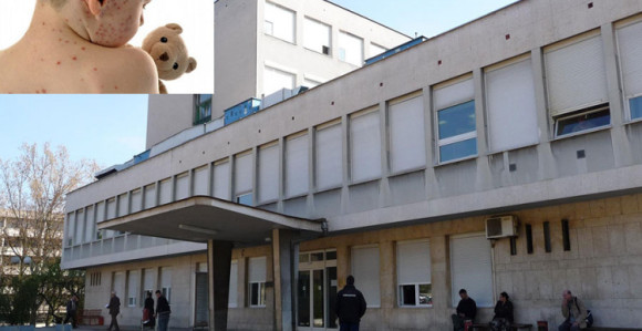 Strah od morbila skraćuje posjete