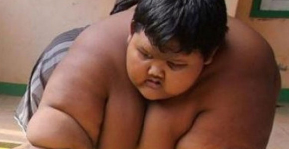 Смршао најдебљи дјечак на свијету