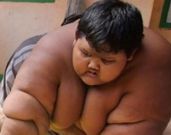 Smršao najdeblji dječak na svijetu