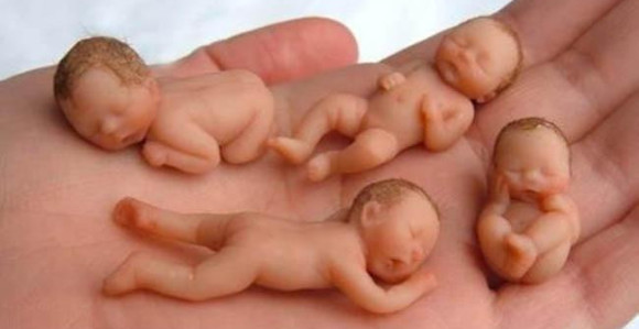 Kažnjena jer je odbila da obavi abortus na crveno slovo