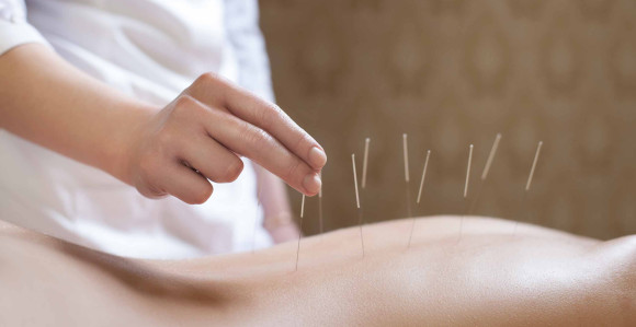 Akupunktura dobra protiv bolesti ?