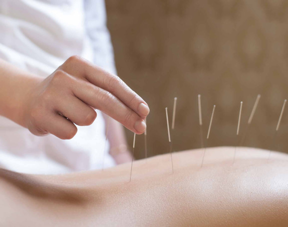 Akupunktura dobra protiv bolesti ?