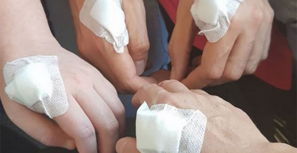 Швеђани уграђују чипове у шаке