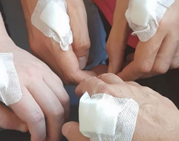 Šveđani ugrađuju čipove u šake