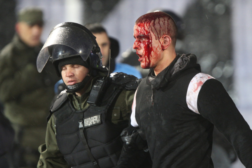 Ima povrijeđenih navijača 