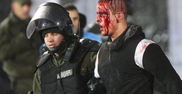 Ima povrijeđenih navijača 