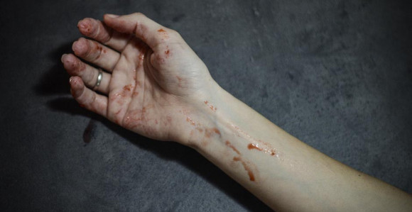 UŽAS: Navijači Boke ubili navijača River Plejta!