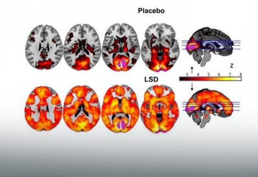 Научници скенирали мозак на ЛСД-у