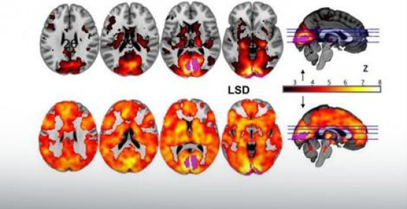 Naučnici skenirali mozak na LSD-u