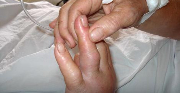 Skupljala drva, pa se uhvatila za poskoka