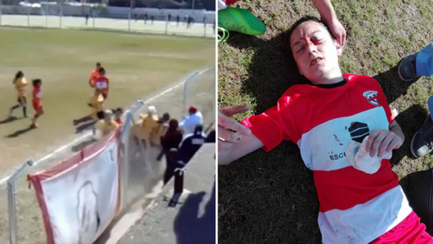 Video: Tuča fudbalerki, četiri završile u bolnici!