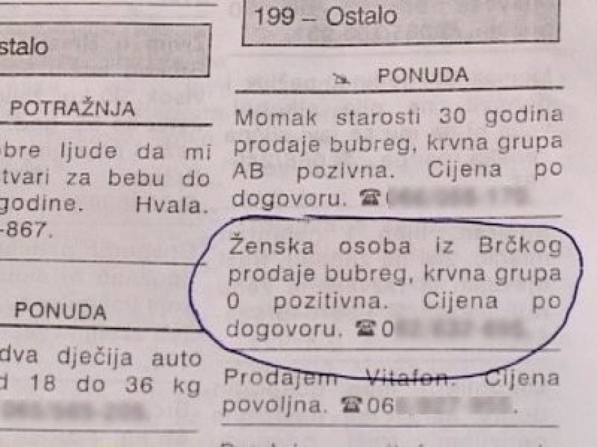 Brčanka oglasila prodaju bubrega (VIDEO)