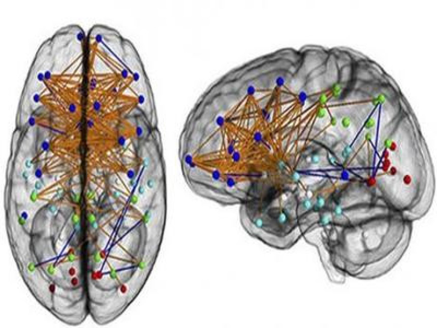 Muški i ženski mozak su potpuno različiti