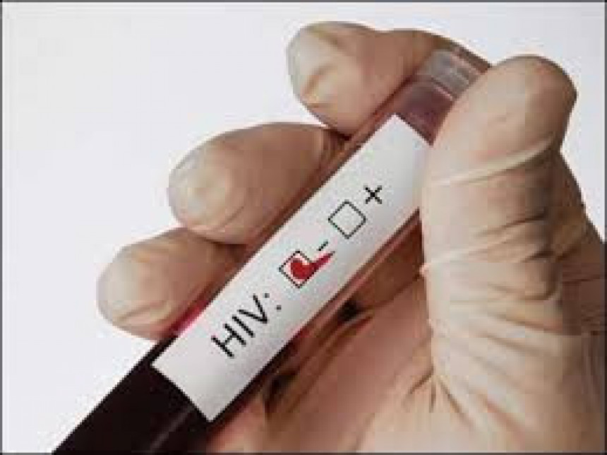 Povećan broj oboljelih od HIV-a