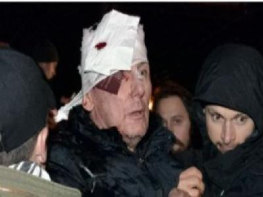 U sukobu u Kijevu povrijeđen bivši ministar