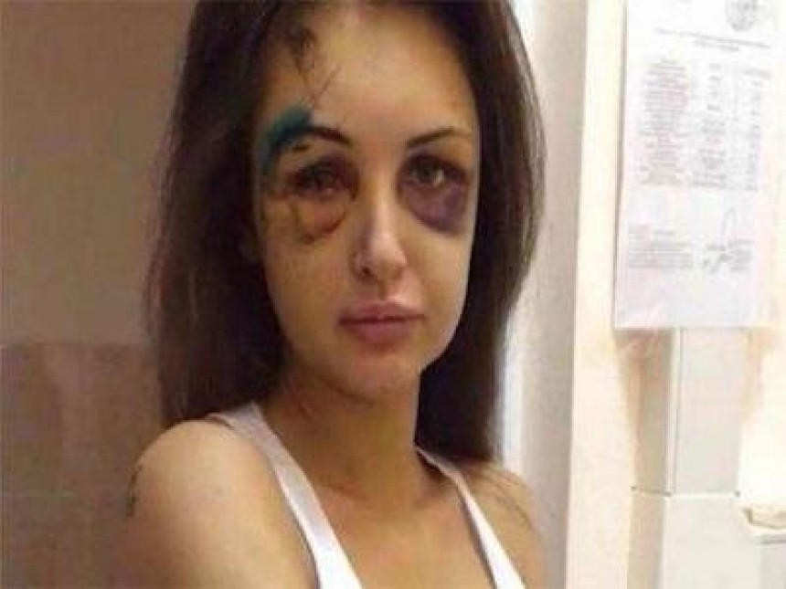 Милионер брутално претукао дјевојку