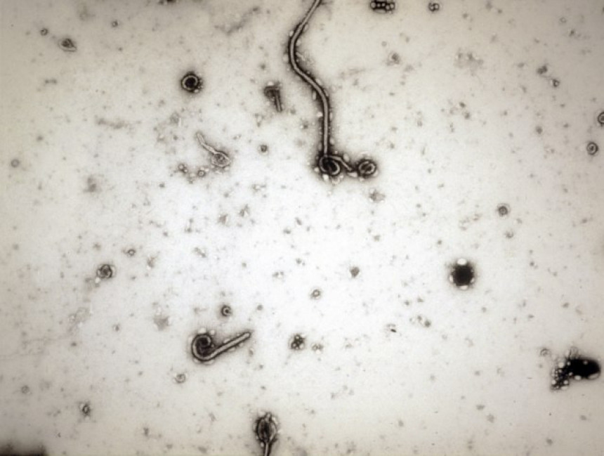 Ebola stigla i do Amerike