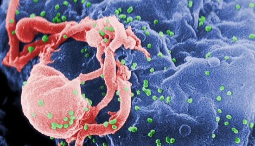 Са ХИВ-ом излијечен рак