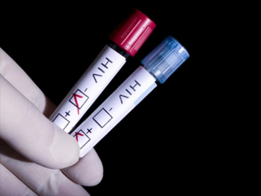 Vojvodina: 34 nova slučaja HIV infekcije