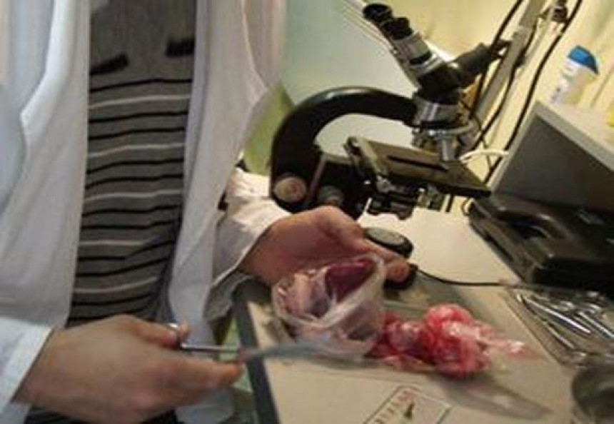  Bijeljina: Dva slučaja trihineloze 