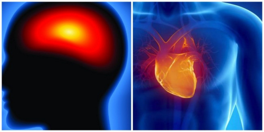 Da li vam prijeti srčani ili moždani udar?