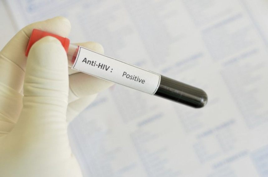 Otkriven molekul koji može da blokira HIV virus