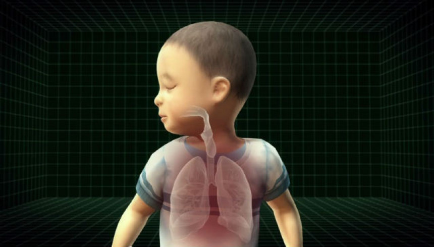 3Д имплант спасао живот дјечацима