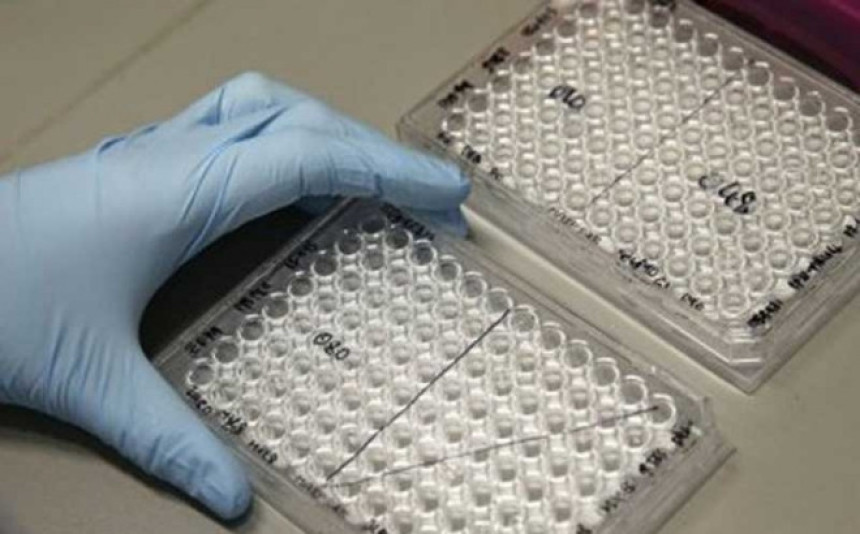 Хемичар из Србије открио лијек за еболу