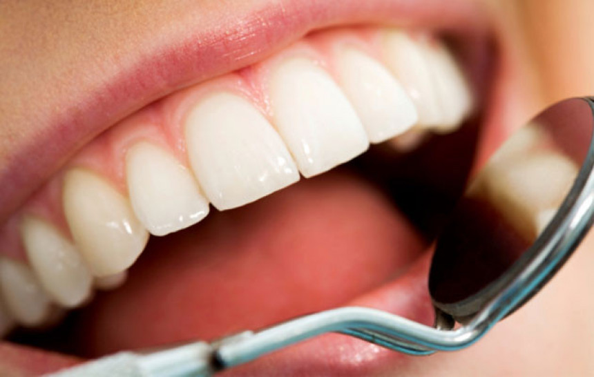 Slaba dentalna higijena uzrok srčanih bolesti