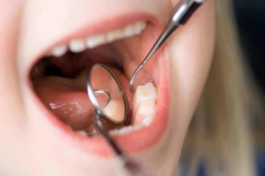 Најважнија правила за очување здравља зуба