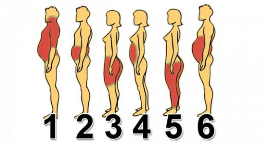 Сазнајте у који тип гојазности спадате