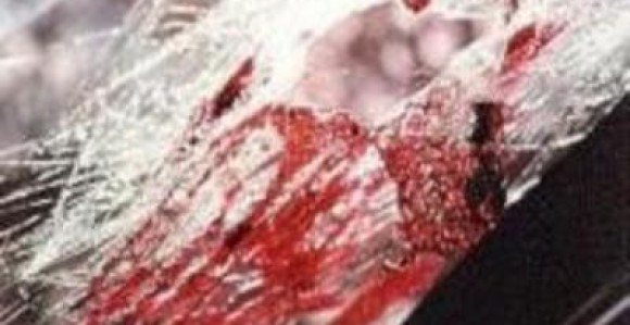 Teška nesreća kod Šapca: Poginuo mladić