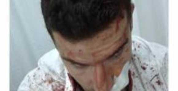 Bivši reprezentativac u boksu povrijeđen u tuči